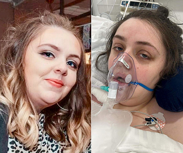 Touha po kráse málem stála Britku život. Operaci by si prý nyní rozmyslela